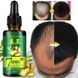 Clothes of Skin Имбирная сыворотка для волос 7 Days Hair Growth Essential Oil (30 мл) 955889 фото 4 JapanTrading