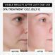 Spa Treatment Карбоксы маска для глубокой регенерации кожи лица CO2 Jelly G (набор для 5 процедур) up509342 фото 6 JapanTrading