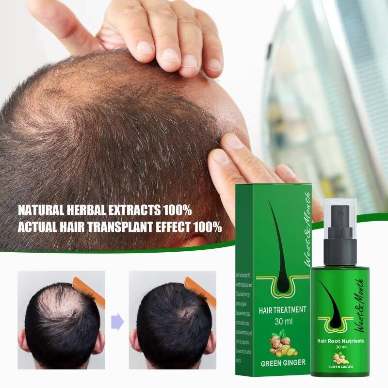 Green Ginger Спрей-сыворотка для роста волос Hair Treatment West & Month 30 мл - JapanTrading