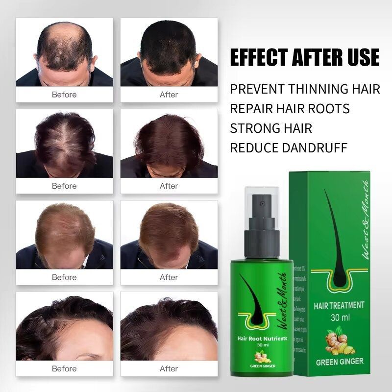 Green Ginger Спрей-сыворотка для роста волос Hair Treatment West & Month 30 мл - JapanTrading