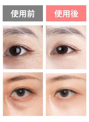 NOVONE Японський апарат для обличчя та шкіри навколо очей з функціями іонофорезу та LED терапії 000116 JapanTrading